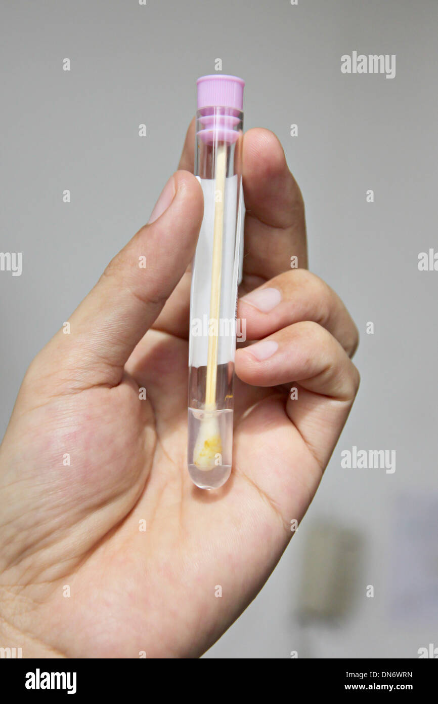 The Picture Stool test with samples inside in hand Stock Photo Alamy