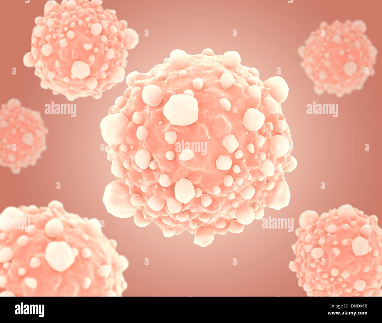 Microscopic view of pancreatic cancer cells. Stock Photo