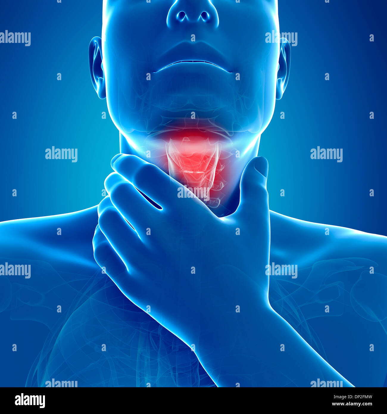 Sore throat, artwork Stock Photo Alamy