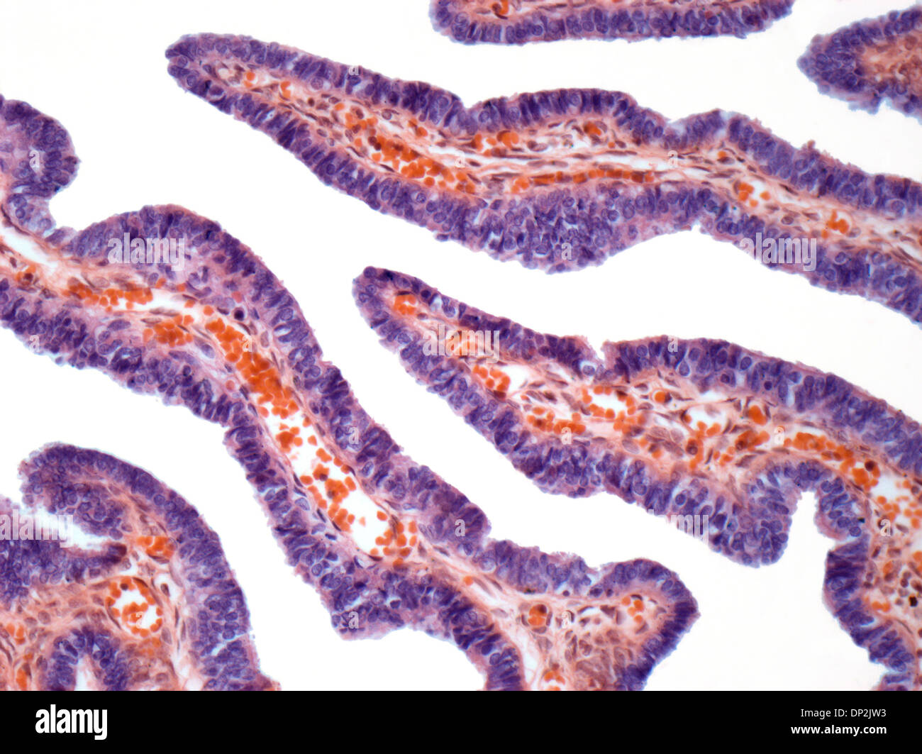 Fallopian tube, light micrograph Stock Photo
