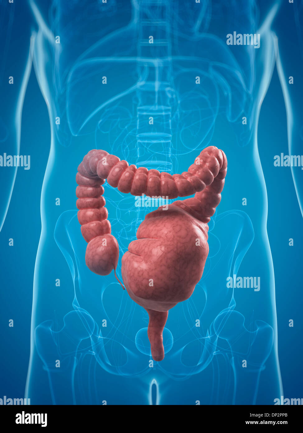Toxic megacolon, artwork Stock Photo 65215315 Alamy