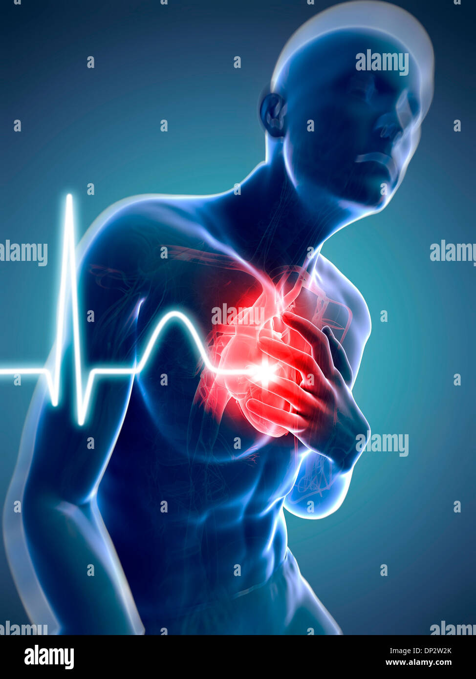 Ms Heart Attack Hot