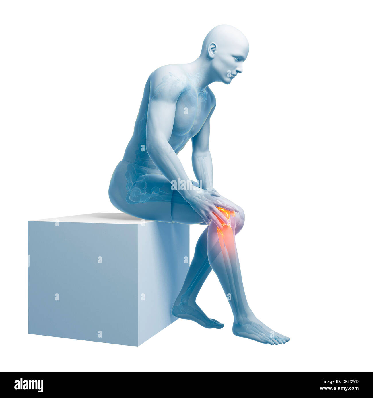Painful knee, artwork Stock Photo Alamy