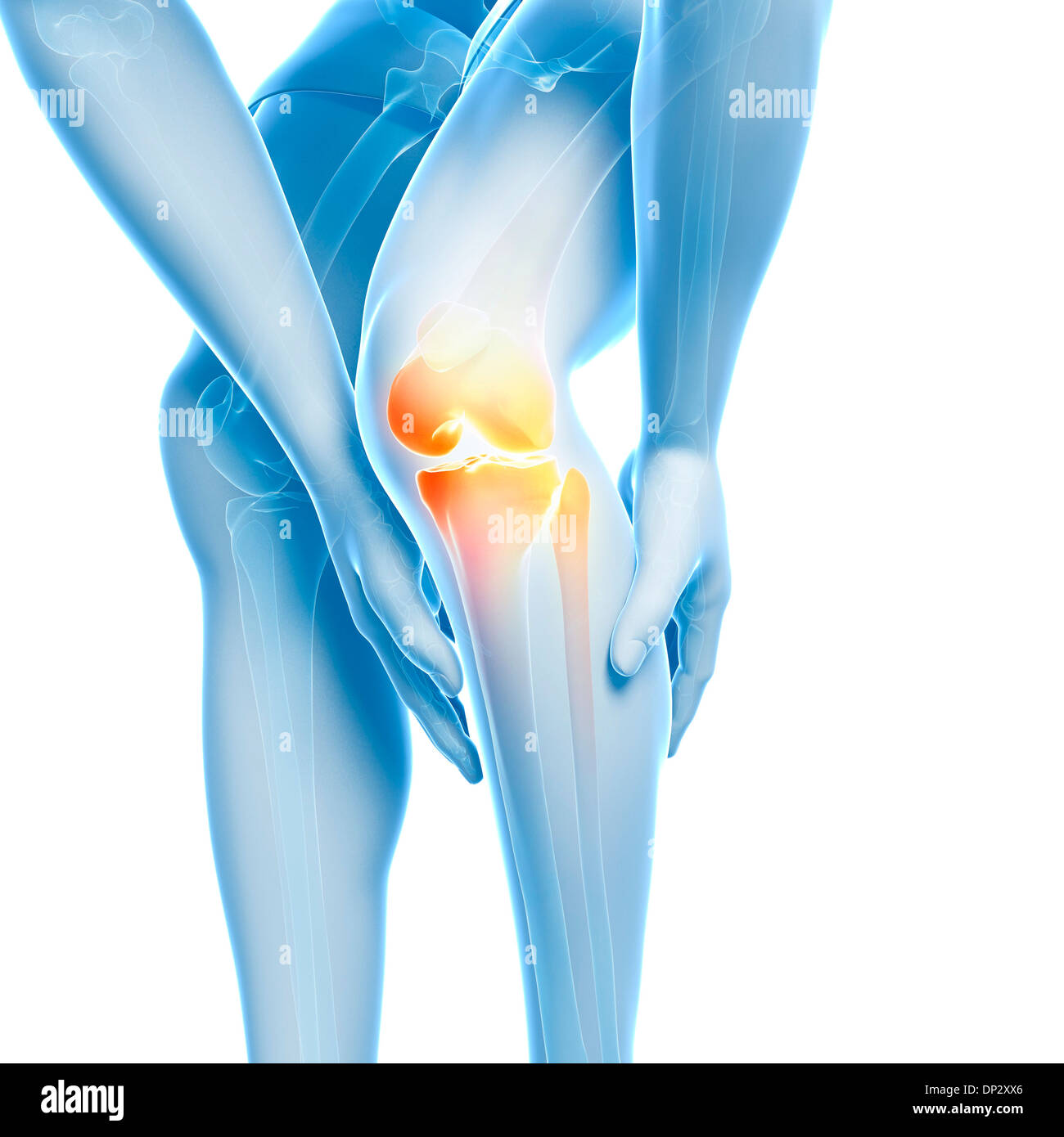 Painful knee, artwork Stock Photo Alamy