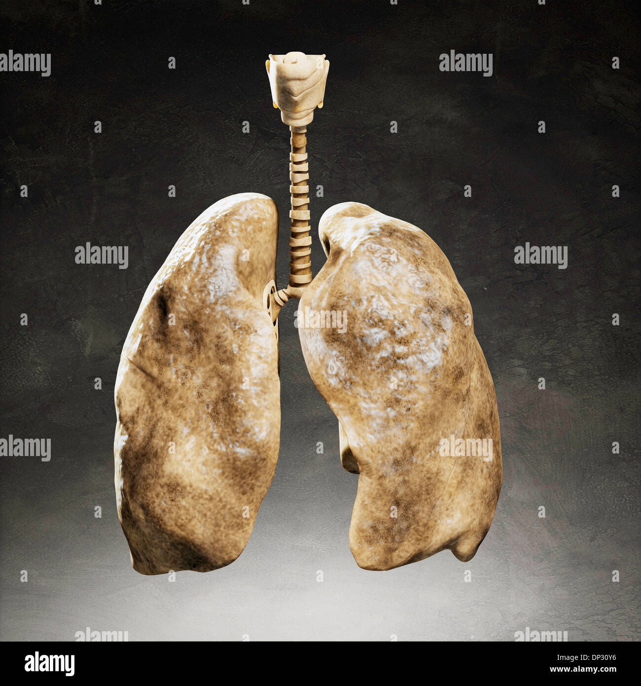 Smoker's lungs, artwork Stock Photo Alamy