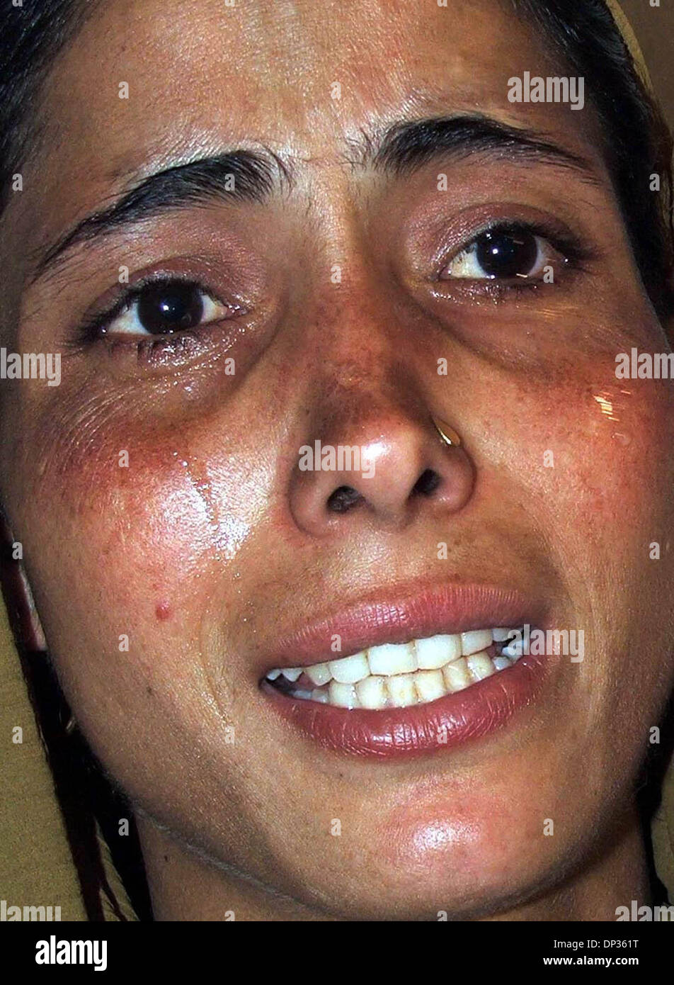 Jun 22, 2006; Spore, Kashmir, INDIA; Relatives of Muslim devotees who were wounded in a grenade explosion cry at a hospital in Srinagar, India, Thursday, June 22, 2006. A hand grenade exploded Thursday during a sermon by a well-known Islamic religious leader addressing dozens of Muslim followers at his home in Sopore, a town 50 kilometers (30 miles) north of Srinagar, in Indian-adm Stock Photo