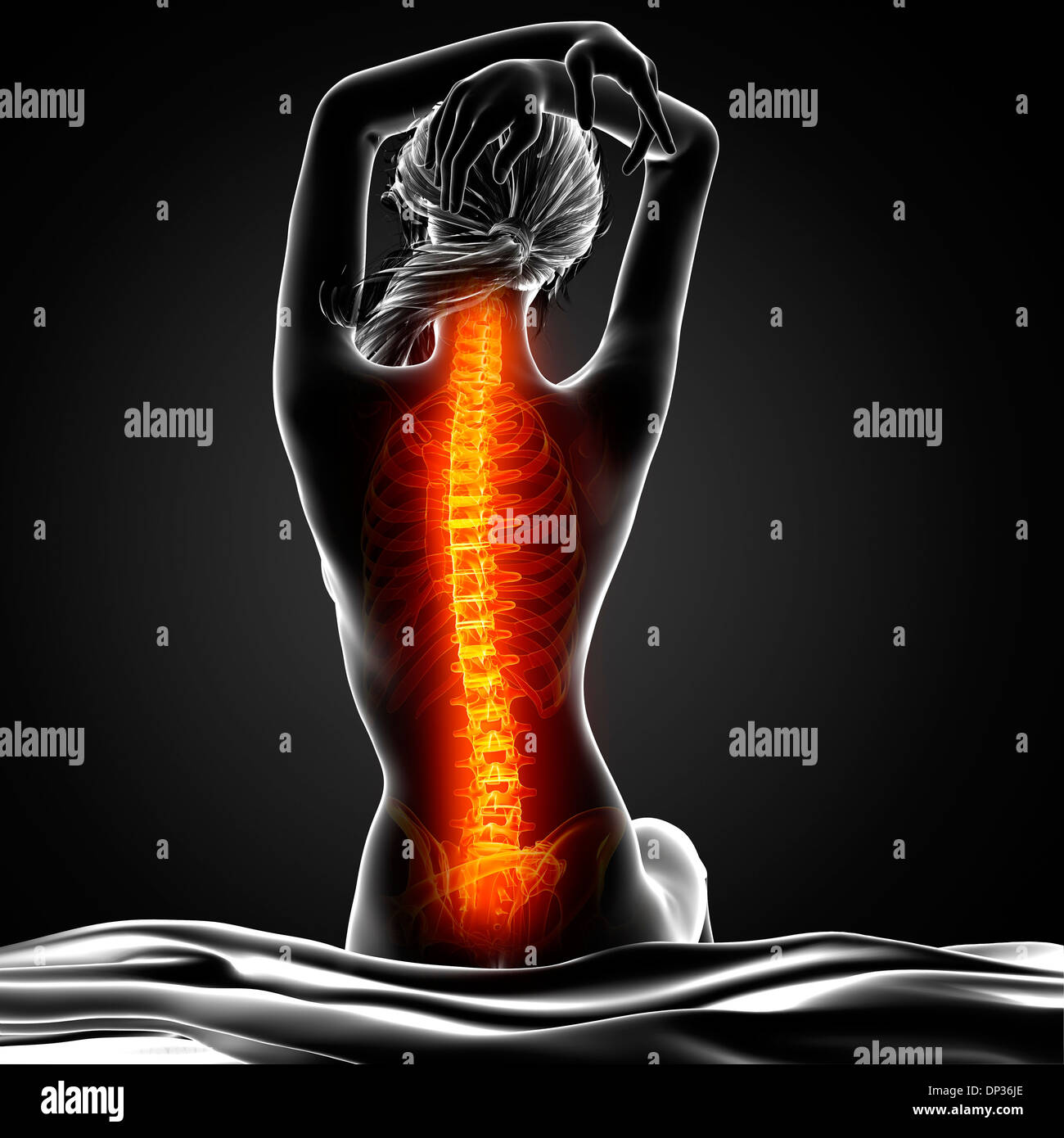 Back pain, artwork Stock Photo