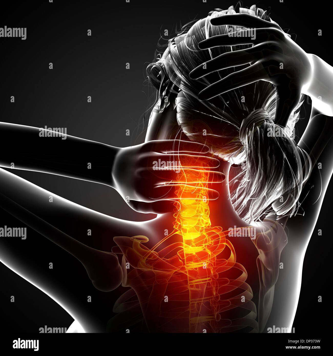 Neck pain, artwork Stock Photo - Alamy