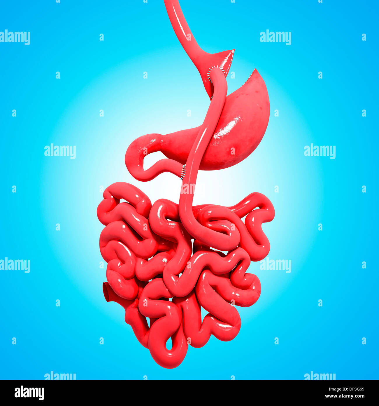 Gastric bypass, artwork Stock Photo Alamy