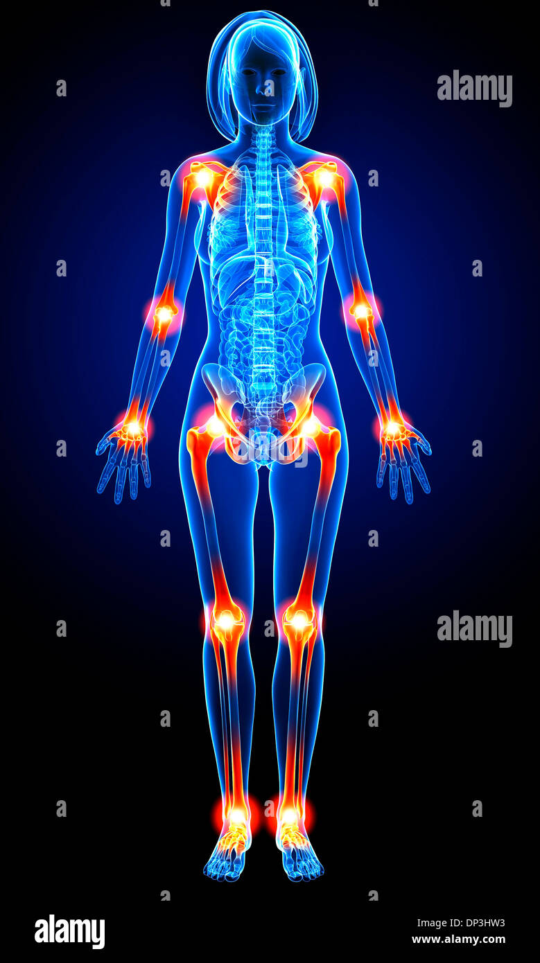 Joint pain hires stock photography and images Alamy