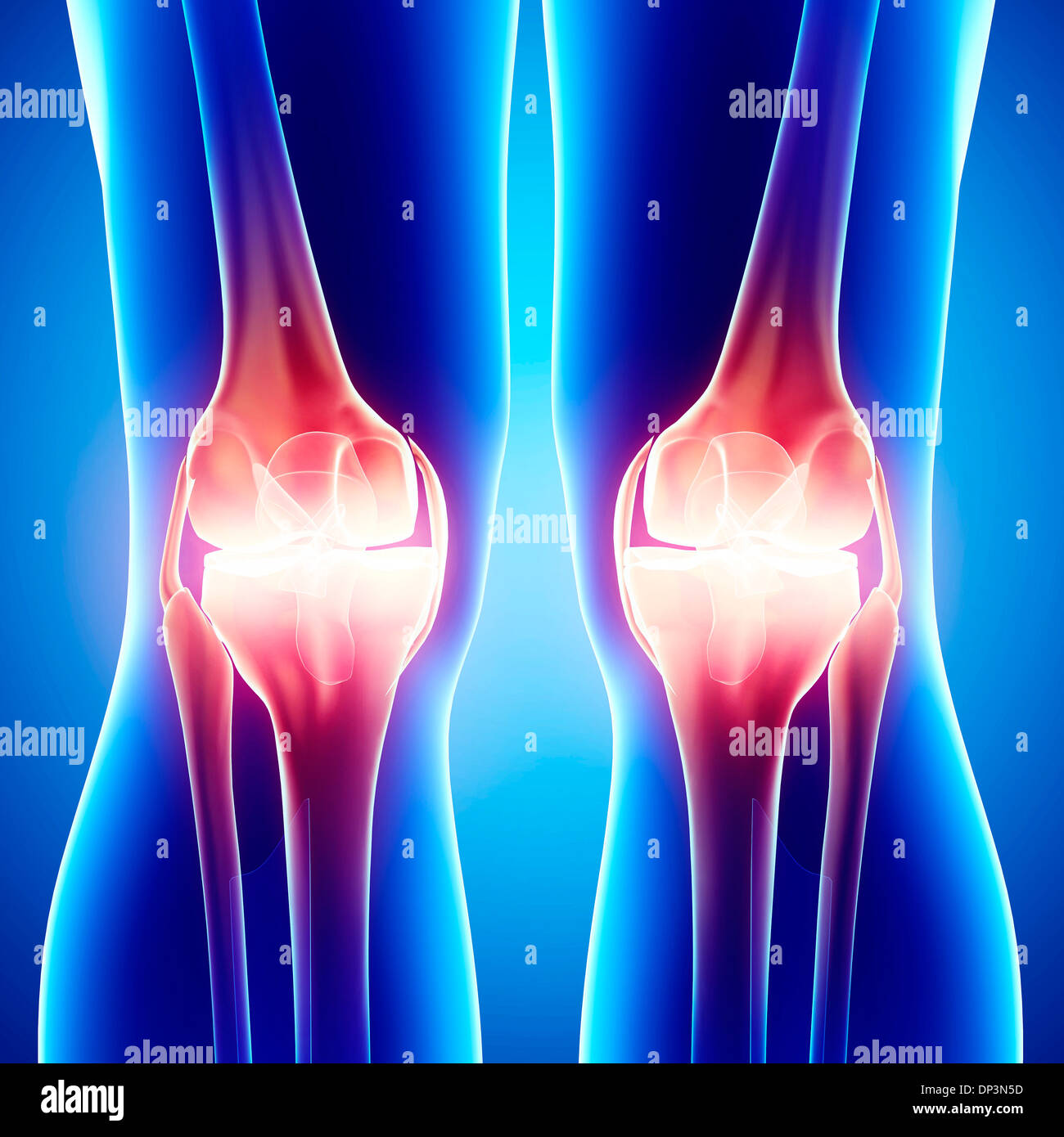 Knee Pain Artwork Stock Photo Alamy knee-pain-artwork-stock-photo-alamy