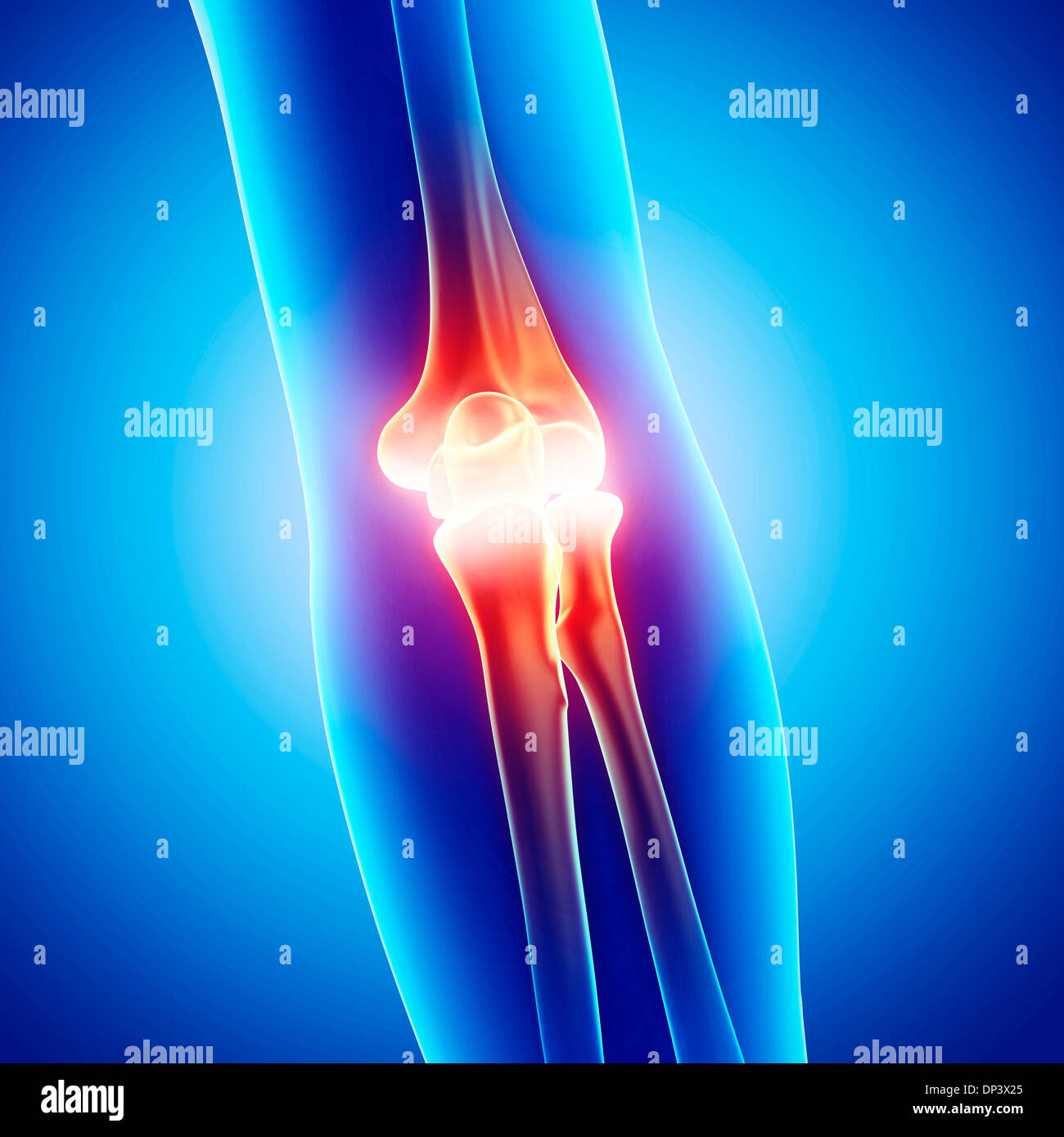 Elbow pain, artwork Stock Photo Alamy