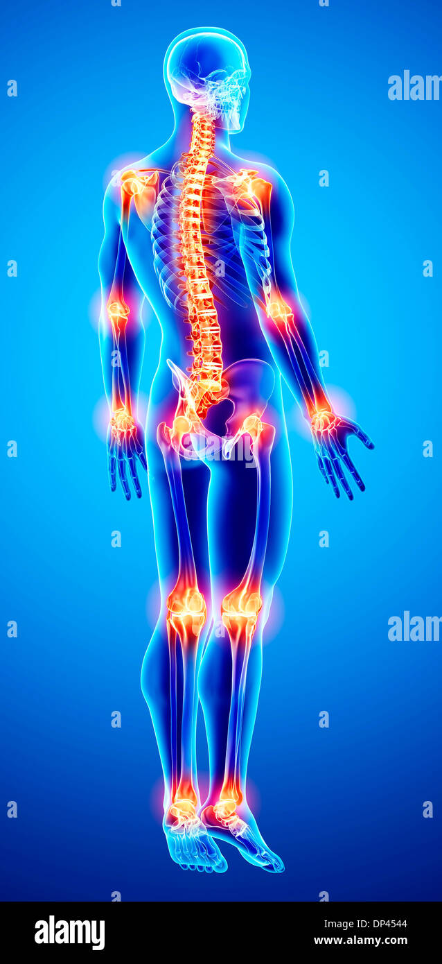 Joint pain hires stock photography and images Alamy