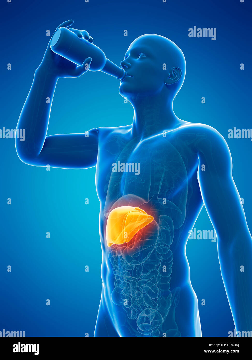 Alcoholic liver disease, artwork Stock Photo