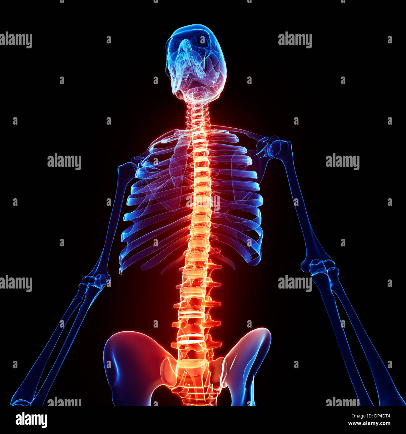 Back pain artwork Stock Photo Alamy