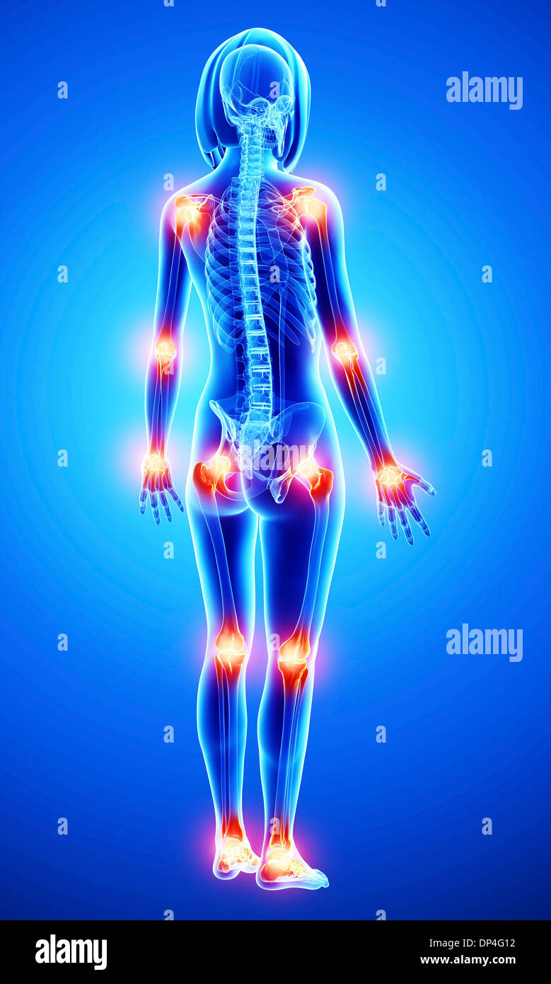 Joint pain, artwork Stock Photo Alamy