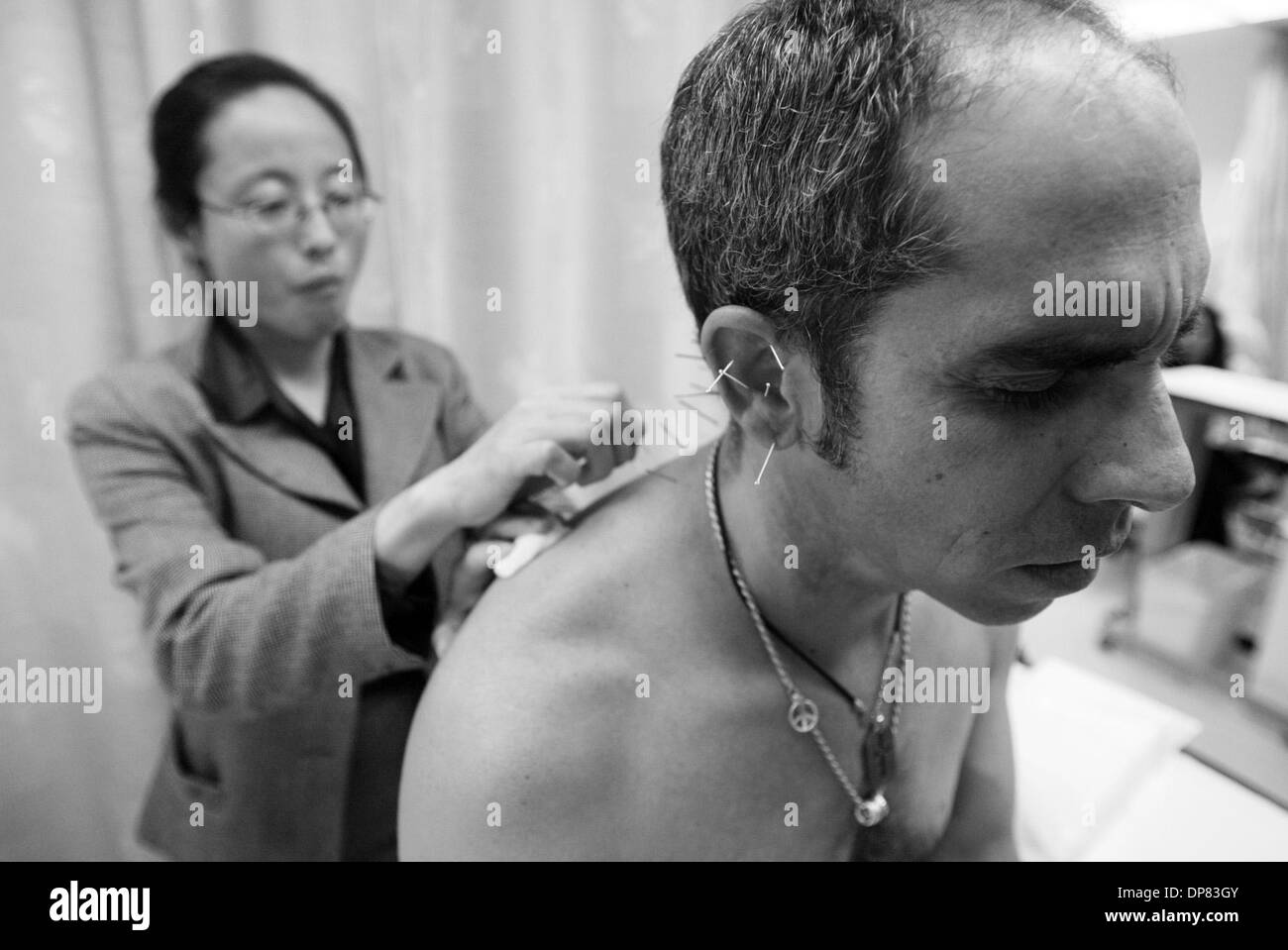 Oct 5, 2006 - San Francisco, CA, USA - Ocular melanoma patient John Shevenell undergoes an acupuncture treatment given by oncologist Dr. Amy Matecki at Alta Bates Summit Comprehensive Cancer Center on Oct. 5, 2006, in Berkeley, Calif. (Credit Image: © Jane Tyska/The Daily Review/ZUMA Press) RESTRICTIONS: USA Tabloid RIGHTS OUT! Stock Photo