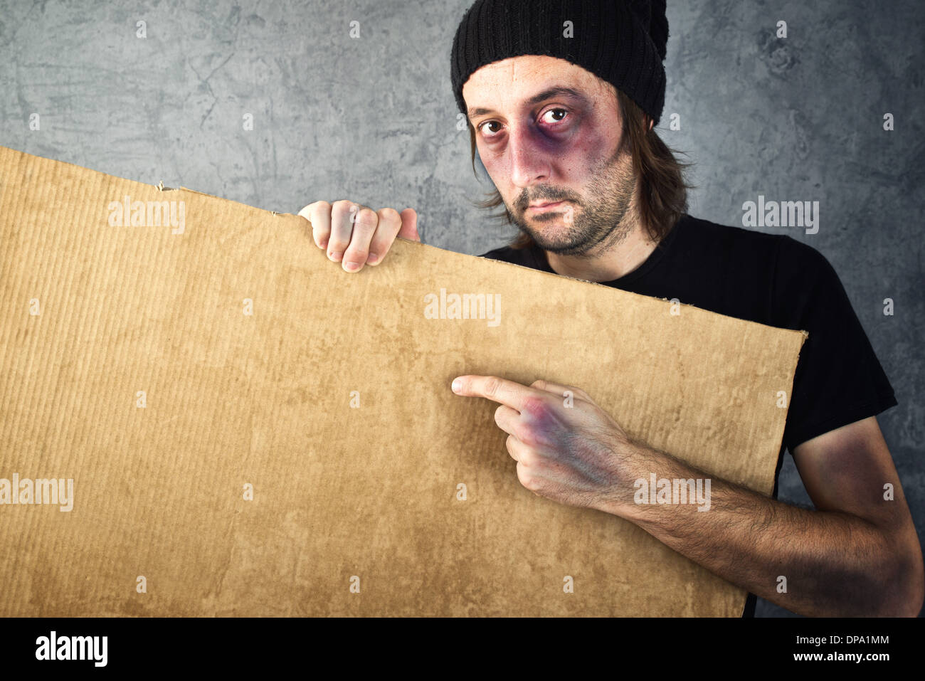Man with bruises holding blank cardboard paper with copy space for your text. Stock Photo