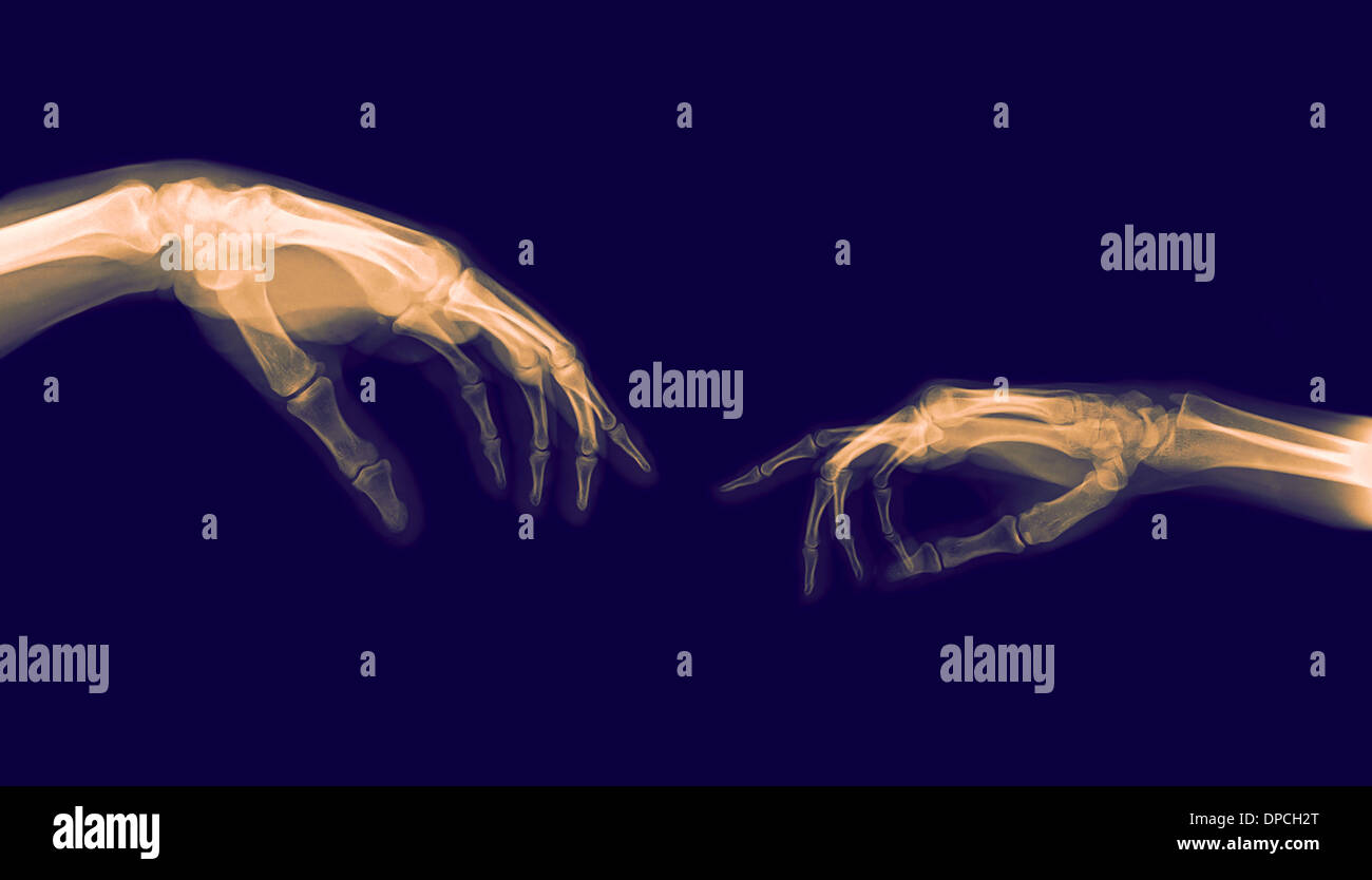 The Creation of Adam (Michelangelo) two hands under x-ray Stock Photo
