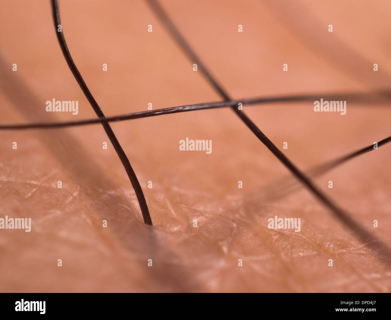 Closeup of coarse human leg hair and skin Stock Photo
