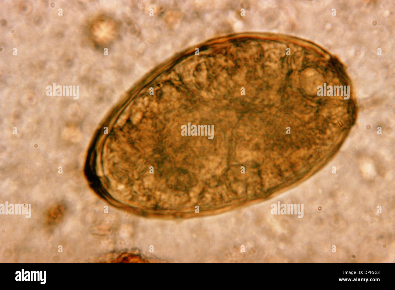 Light micrograph Trematode lung fluke egg Stock Photo