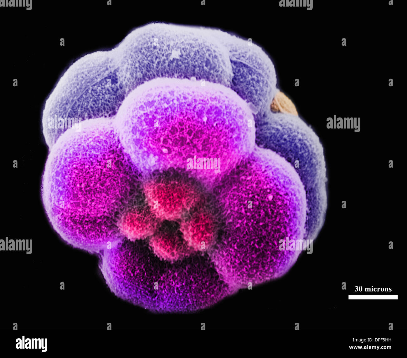 SEM of sea urchin embryo (16 cell stage) Stock Photo