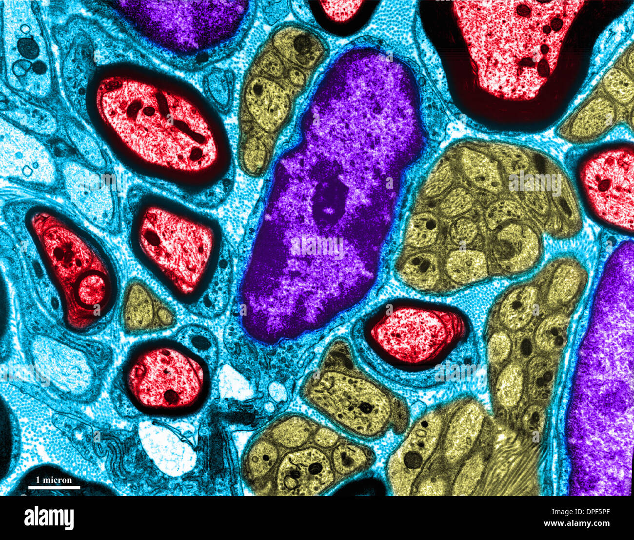 TEM of nerve in mouse lung Stock Photo