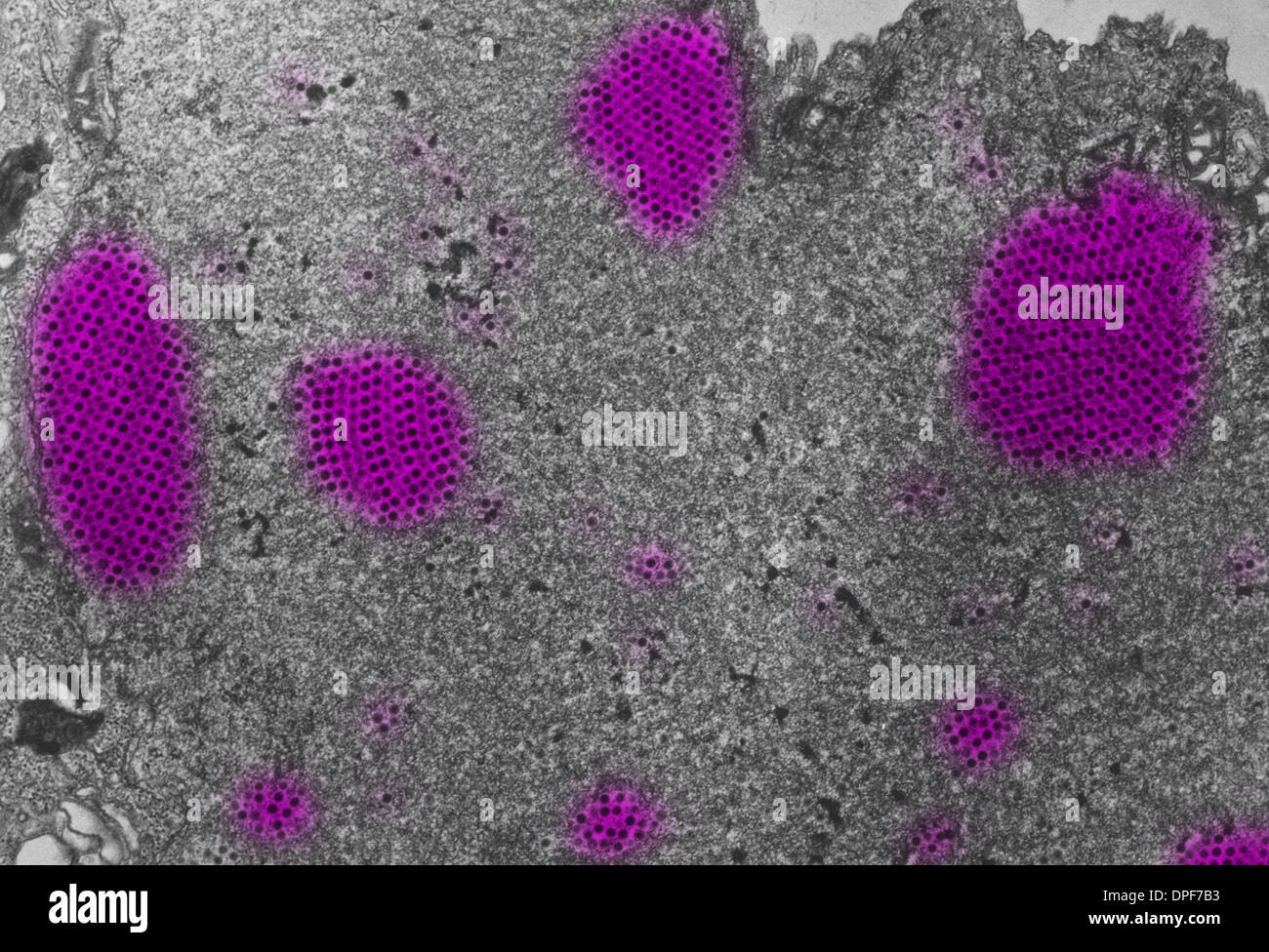 Light micrograph of canine adenovirus type iia Stock Photo