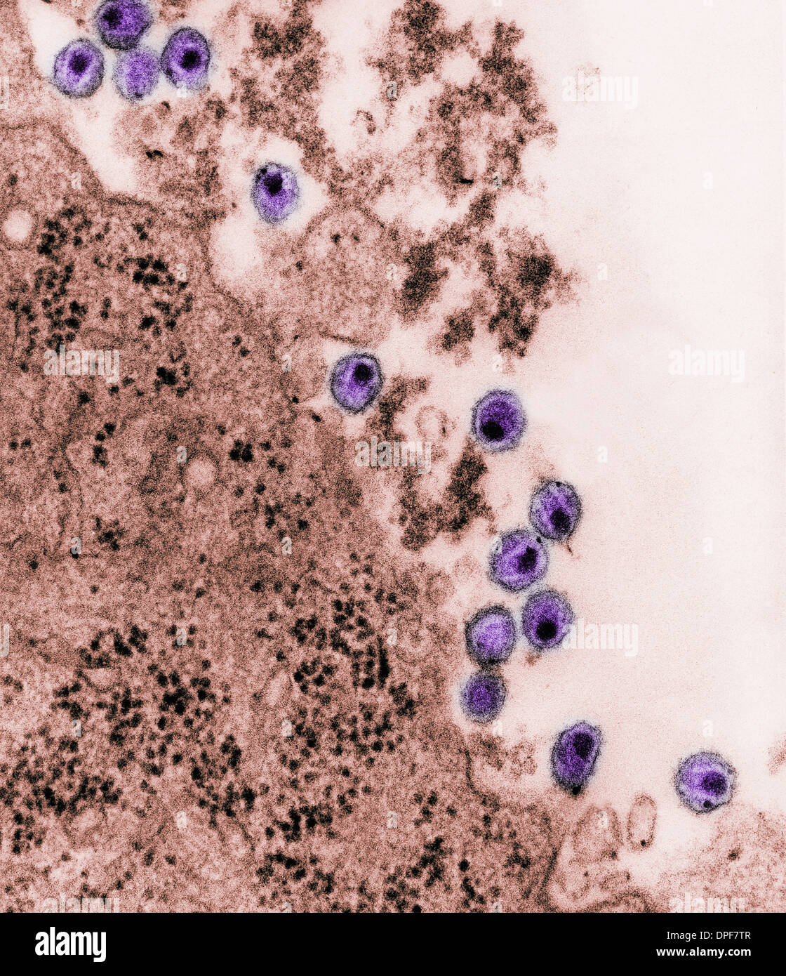 TEM of human immunodeficiency virus (HIV) virions Stock Photo