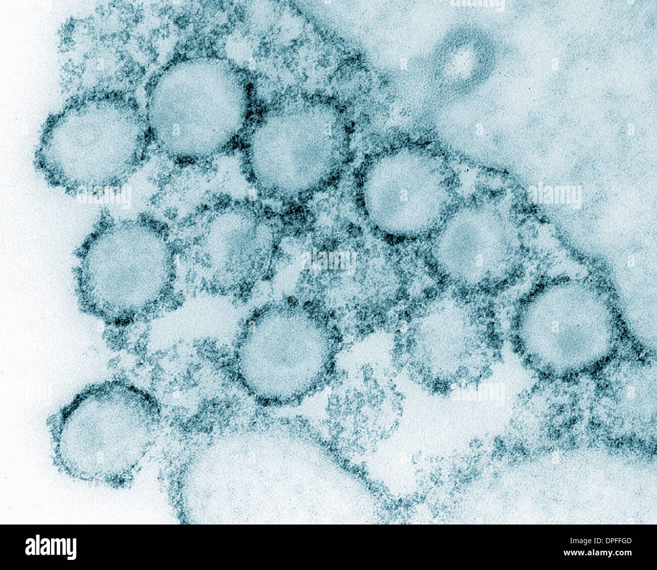 Transmission electron micrograph of AIDS, HIV-1 Stock Photo