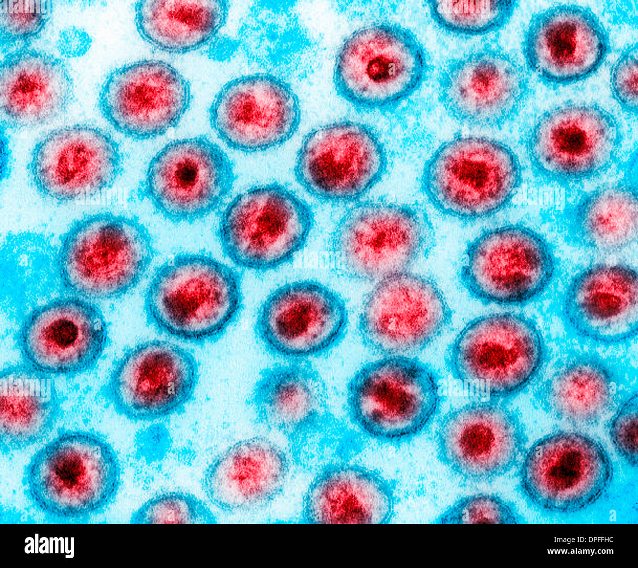 Transmission electron micrograph of AIDS, HIV-1 Stock Photo