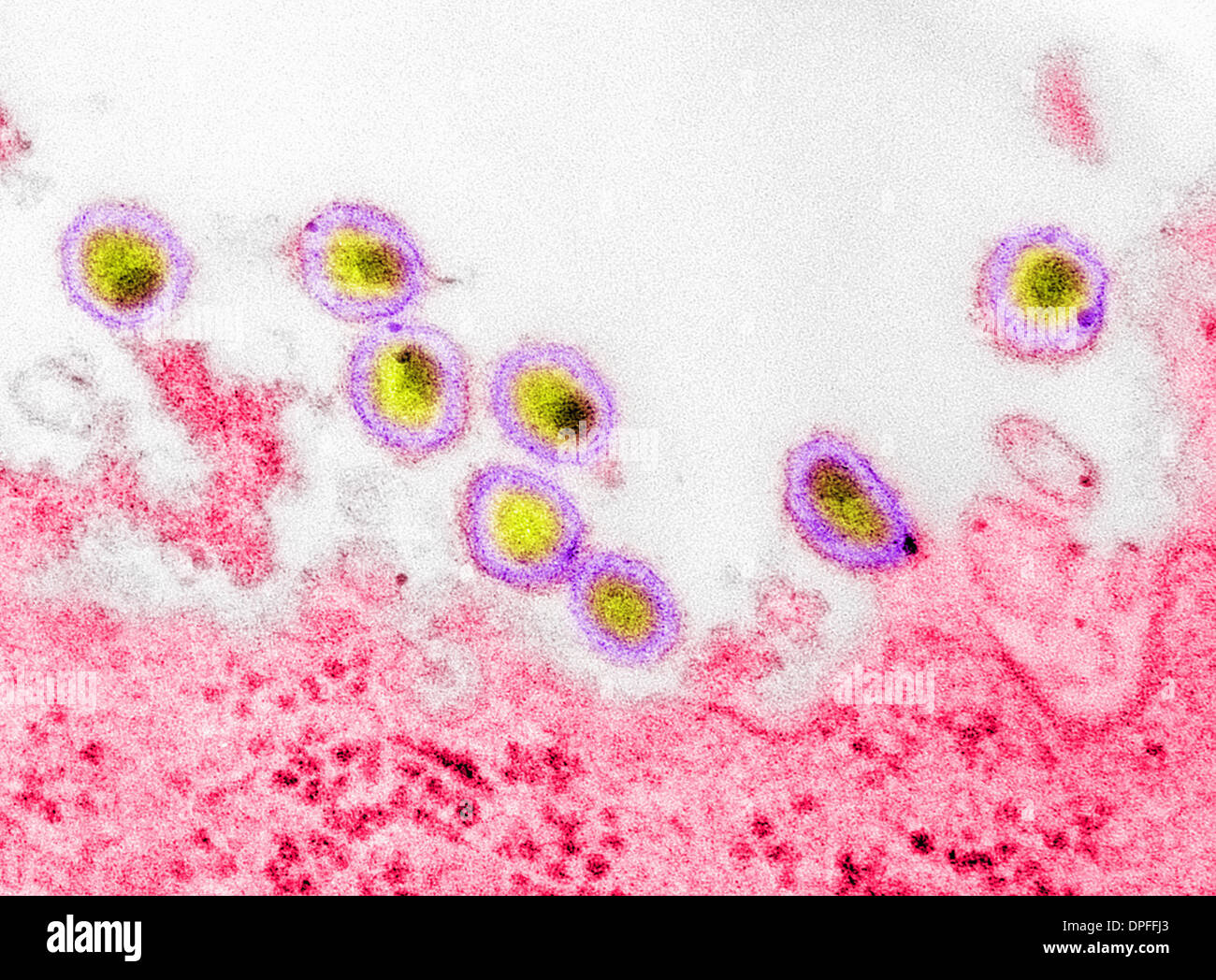 Transmission electron micrograph of AIDS, HIV-1 Stock Photo