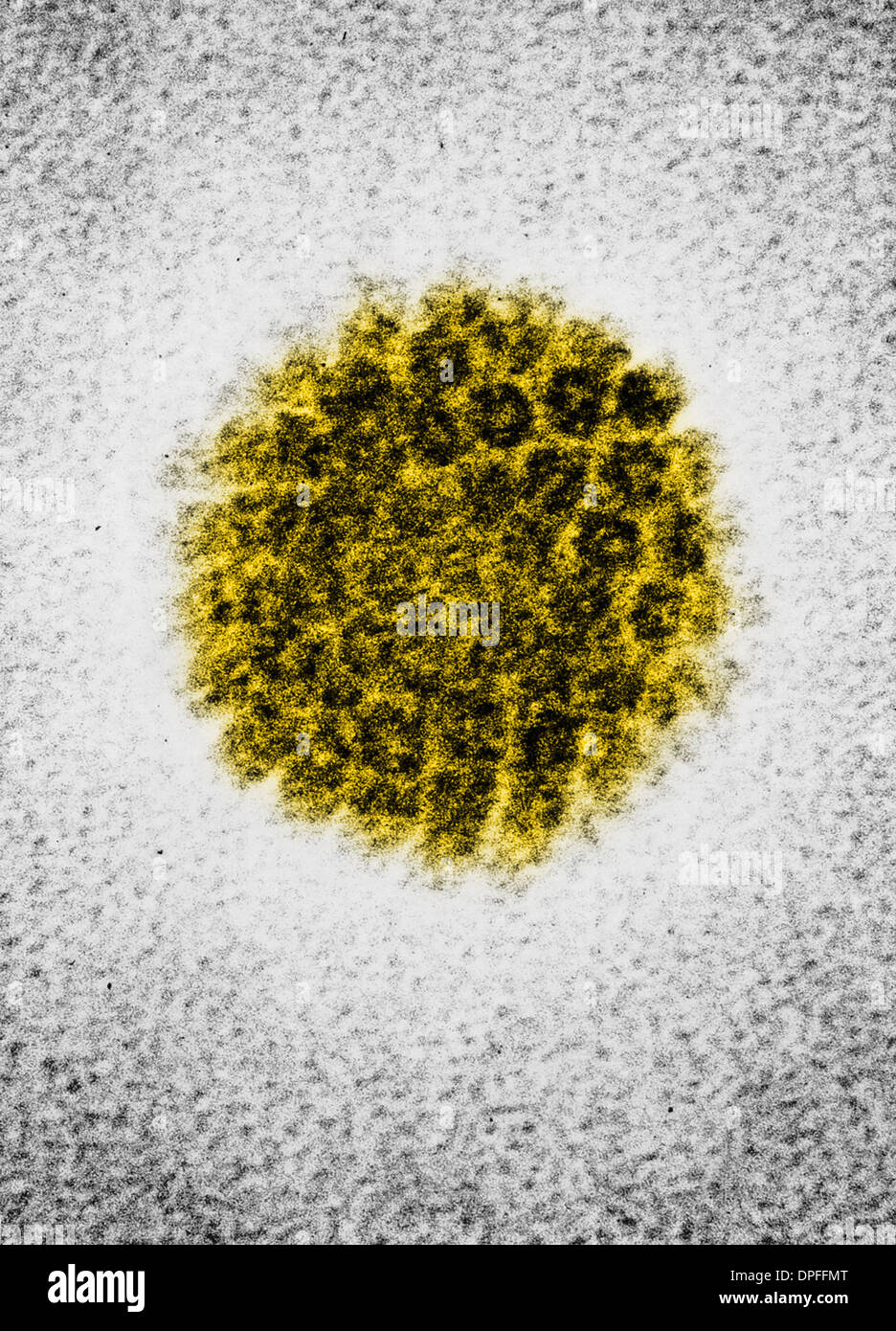 EM of a human papilloma virus (HBV) Stock Photo