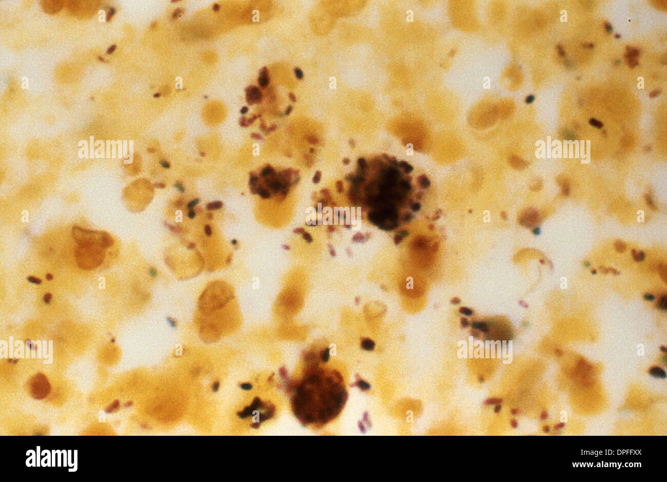 micrograph of Legionella pneumophila bacteria Stock Photo