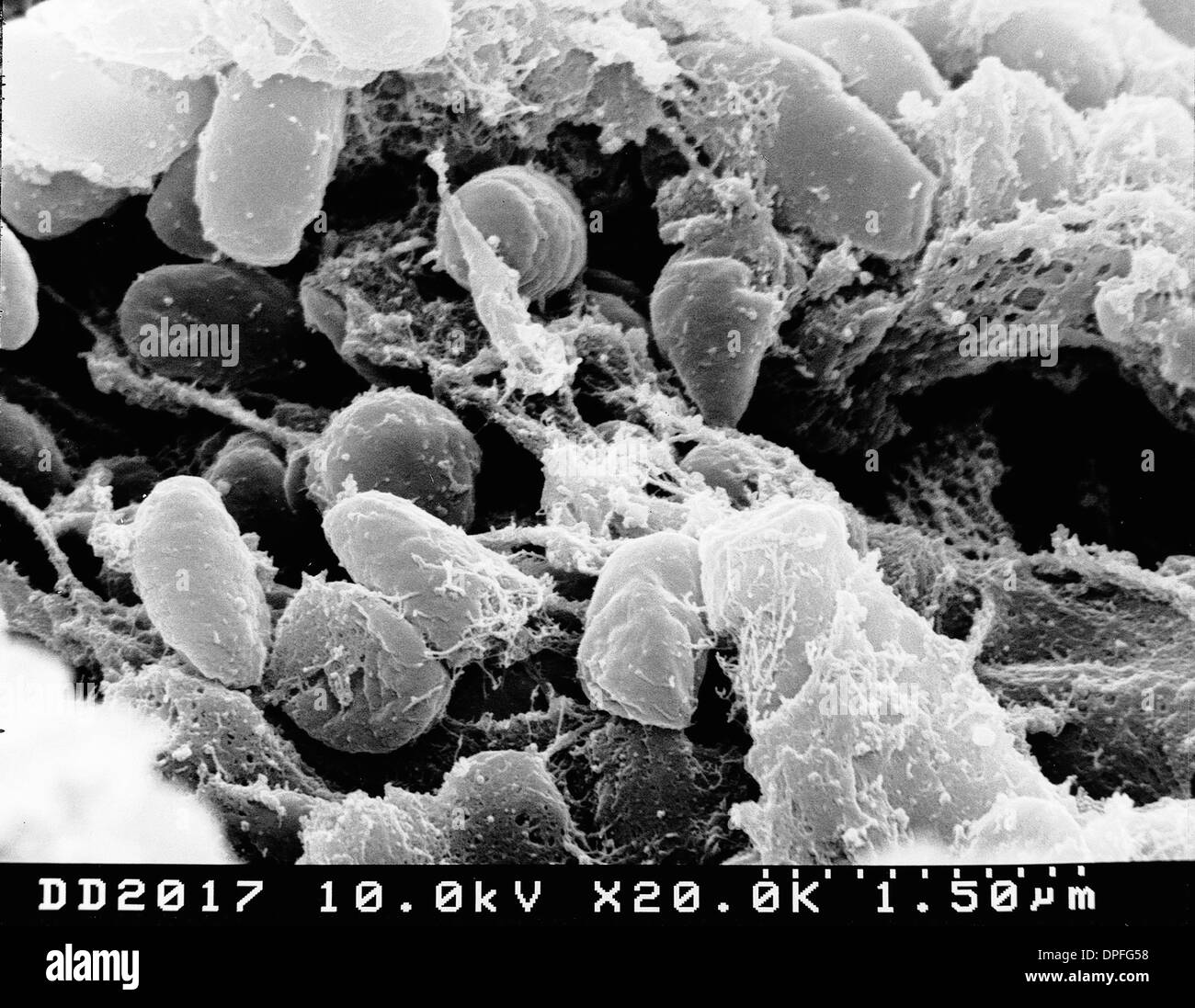 SEM of plague bacteria Stock Photo