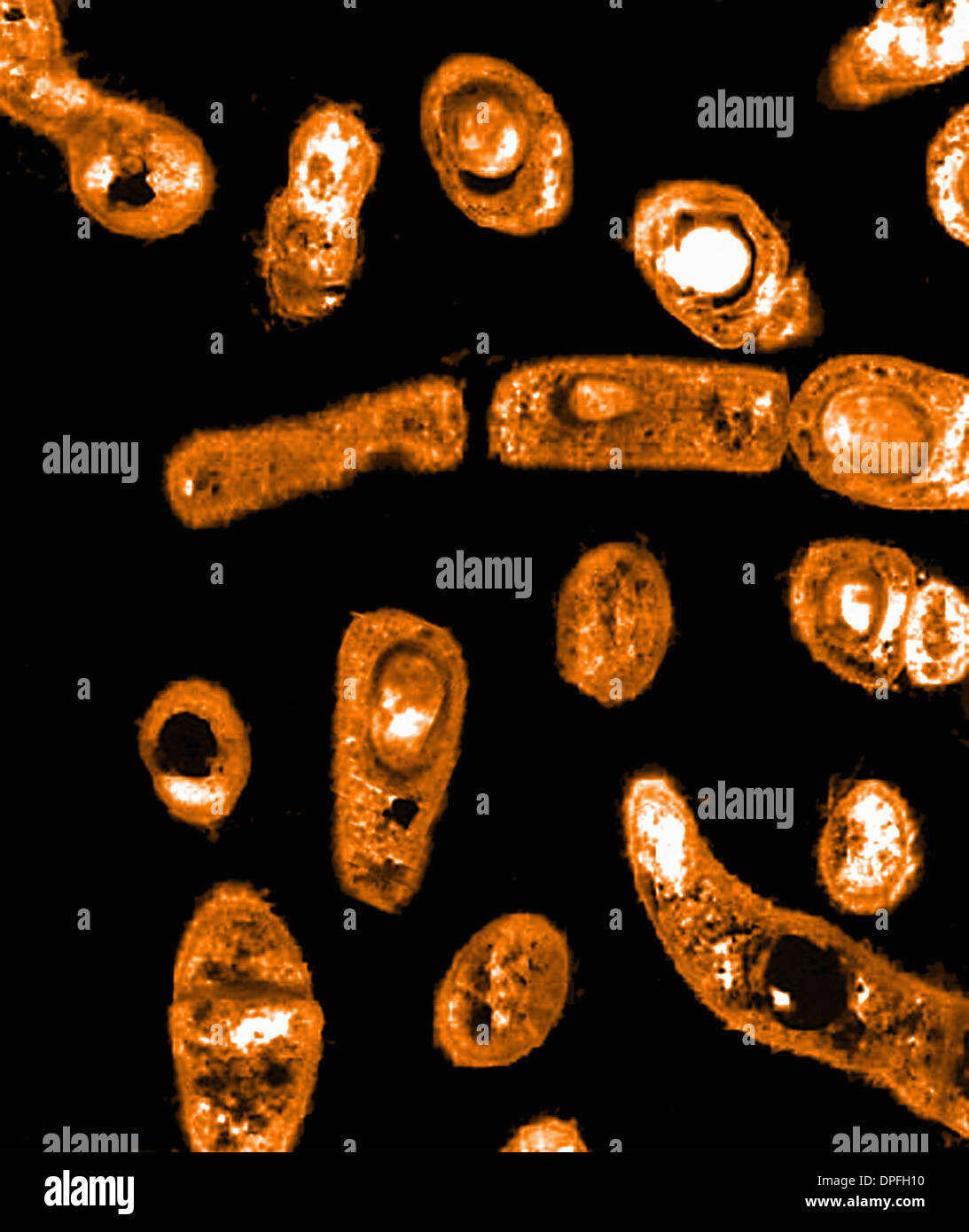 TEM of Anthrax bacteria (Bacillus anthracis) Stock Photo