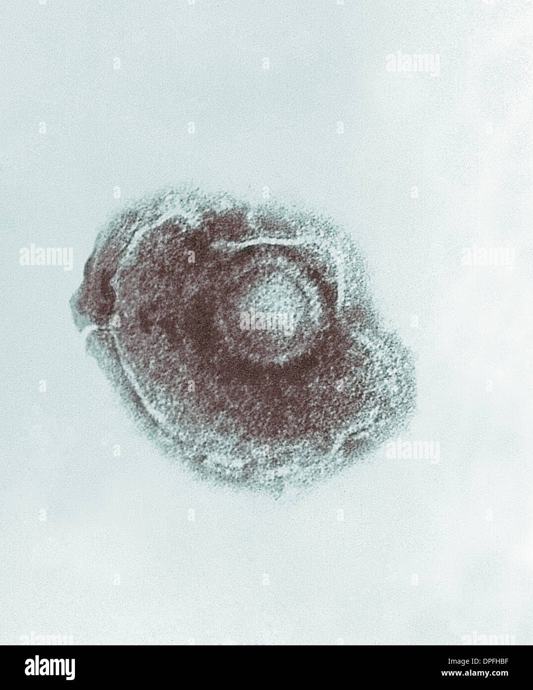 Electronmicrograph of Varicella Chickenpox virus. Stock Photo