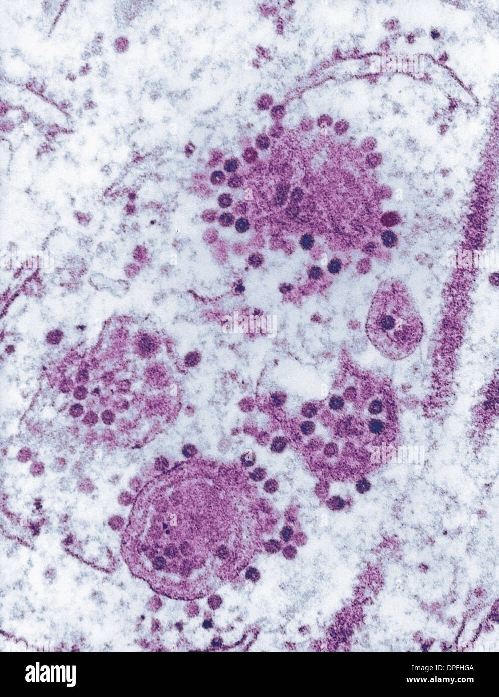 TEM of Eastern Equine Encephalitis (EEE) virus Stock Photo