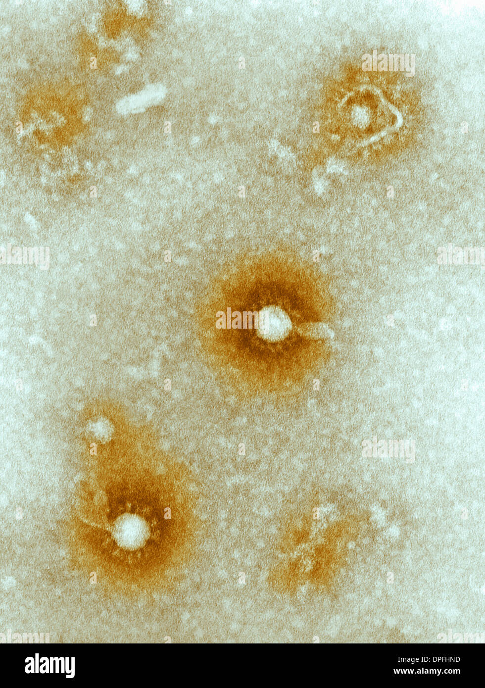 TEM of Eastern Equine Encephalitis (EEE) virus Stock Photo