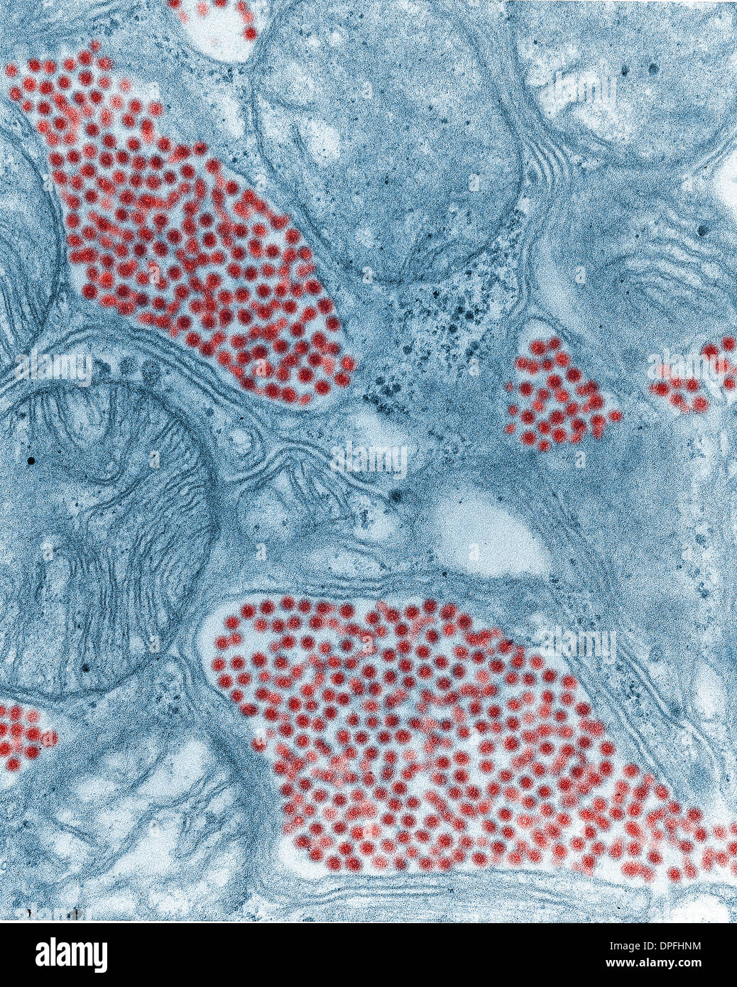 TEM of a mosquito salivary gland with EEE virus Stock Photo