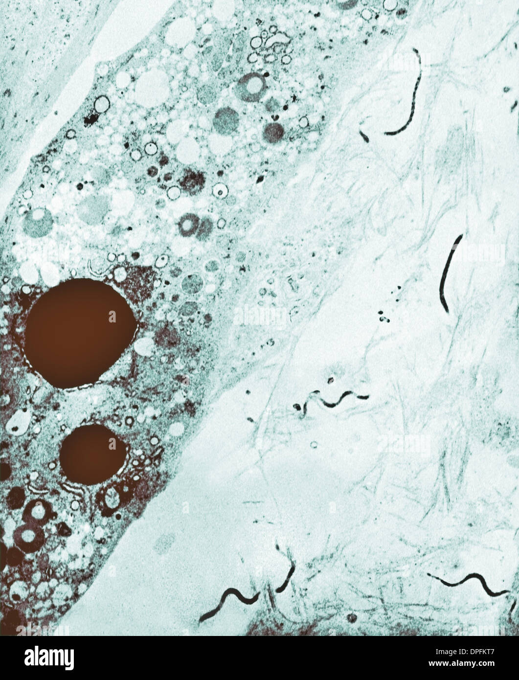 Electron micrograph of Treponema pallidum bacteria Stock Photo