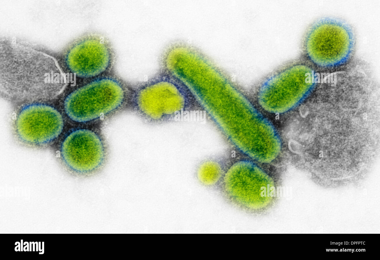 H3n2 influenza virus hi-res stock photography and images - Alamy