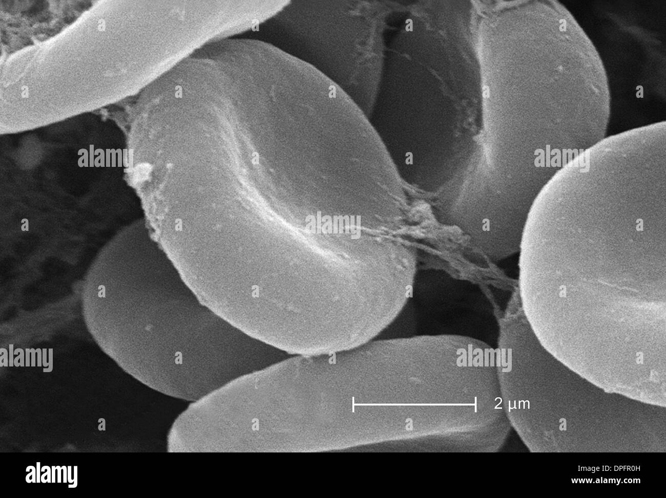 SEM showing rbcs and fibrin Stock Photo