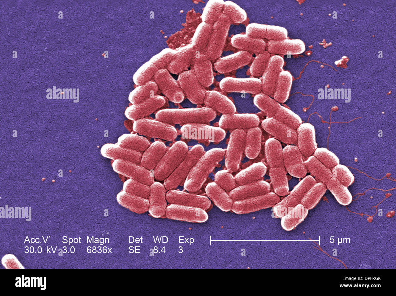 SEM of E. coli O157:H7 Stock Photo