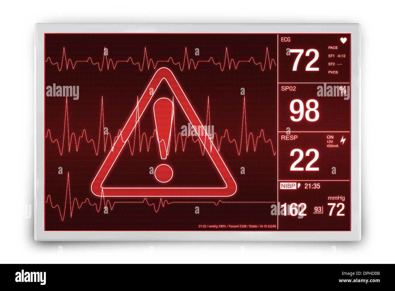 Heart Rate Alarm. Medical Device Isolated on White Concept Illustration