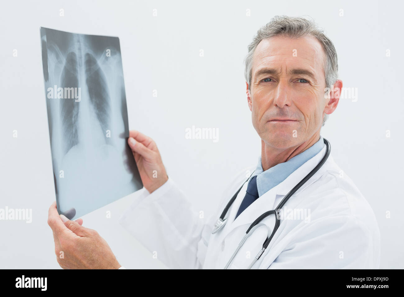 Doctor holding chest x ray hi-res stock photography and images - Alamy