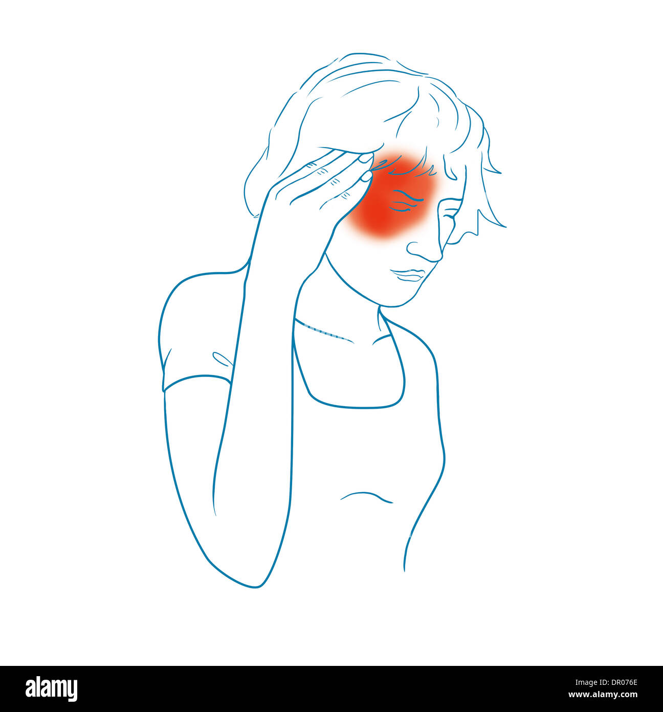 MIGRAINE, ILLUSTRATION Stock Photo