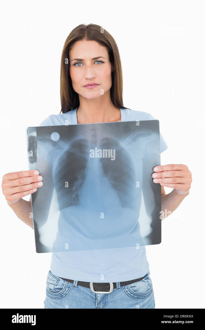 Woman chest x ray hi-res stock photography and images - Alamy