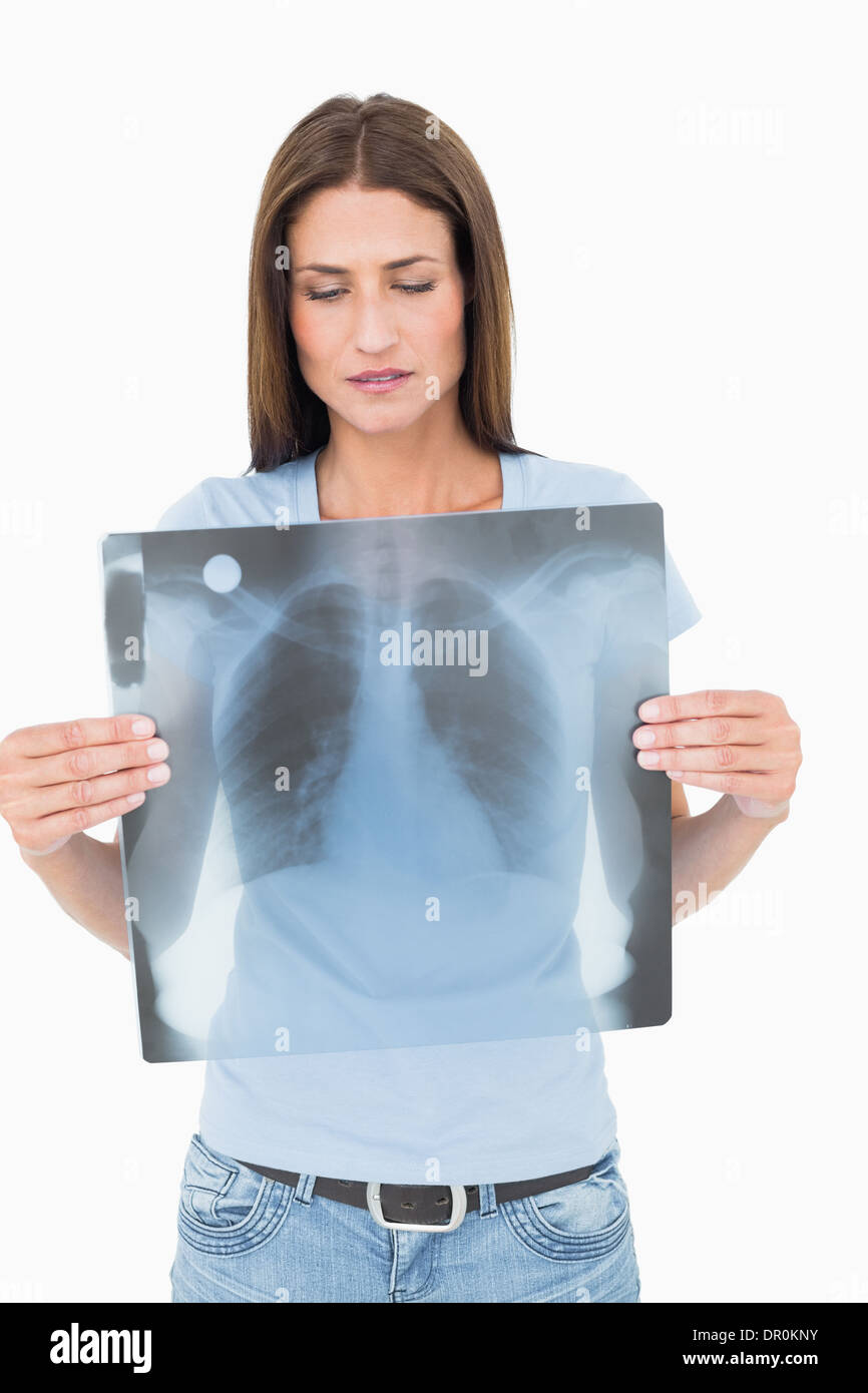 Woman chest x ray hi-res stock photography and images - Alamy
