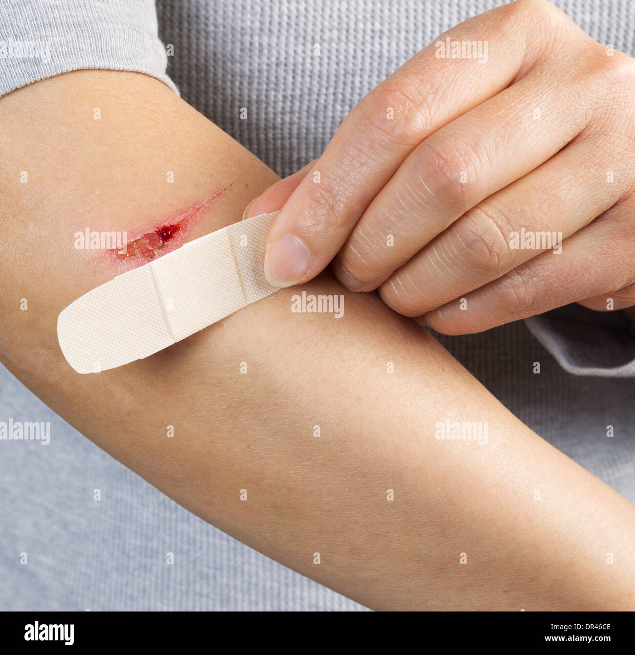 Photo of female hand showing band aid next to cut on forearm Stock Photo